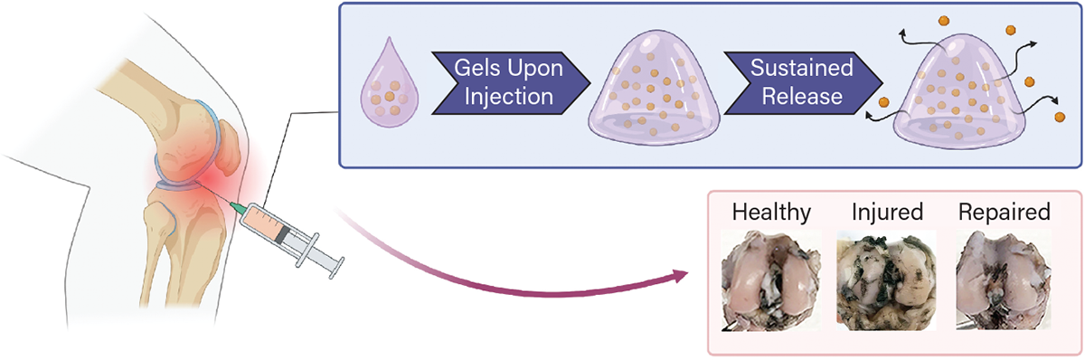 a minimally invasive injectable hydrogel therapy for treating post-traumatic osteoarthritis (PTOA)