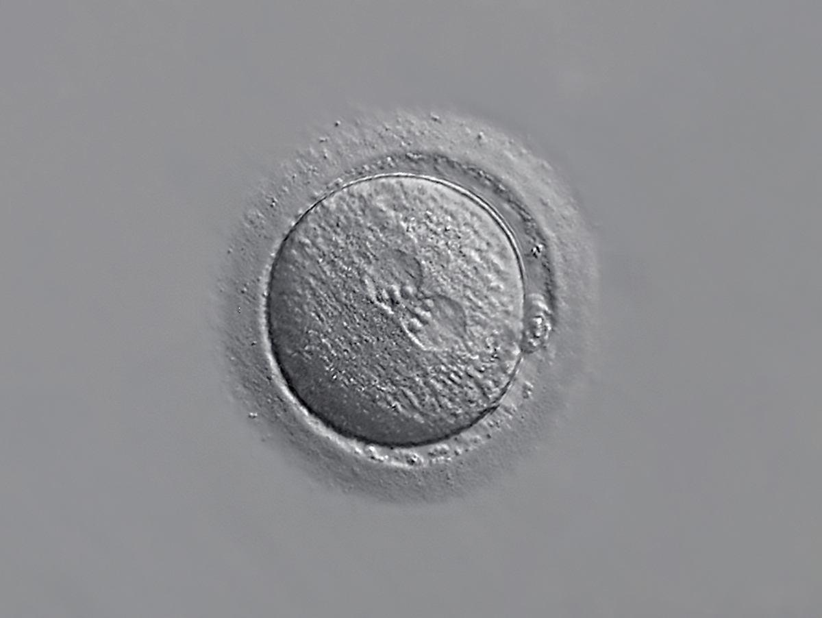 Microscopic image of a human zygote at 20× magnification, illustrating early embryo development and potential screening for successful growth
