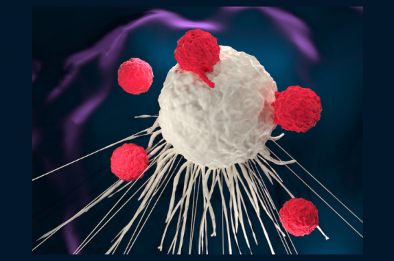 Chimeric antigen receptor (CAR) T-cell therapy uses T-cells gathered from the patient’s own blood. The T-cells are engineered and then infused back into the patient to target and attack cancer cells.